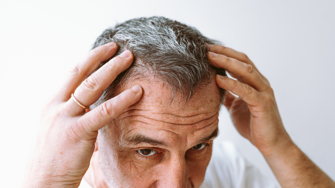 8 Tips To Prevent Hair Loss Before It Starts