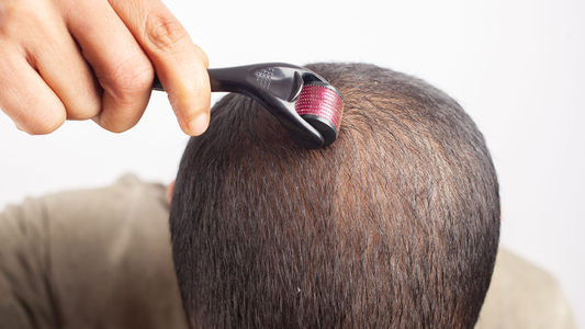 Can Dermarolling Help with Hair Loss?